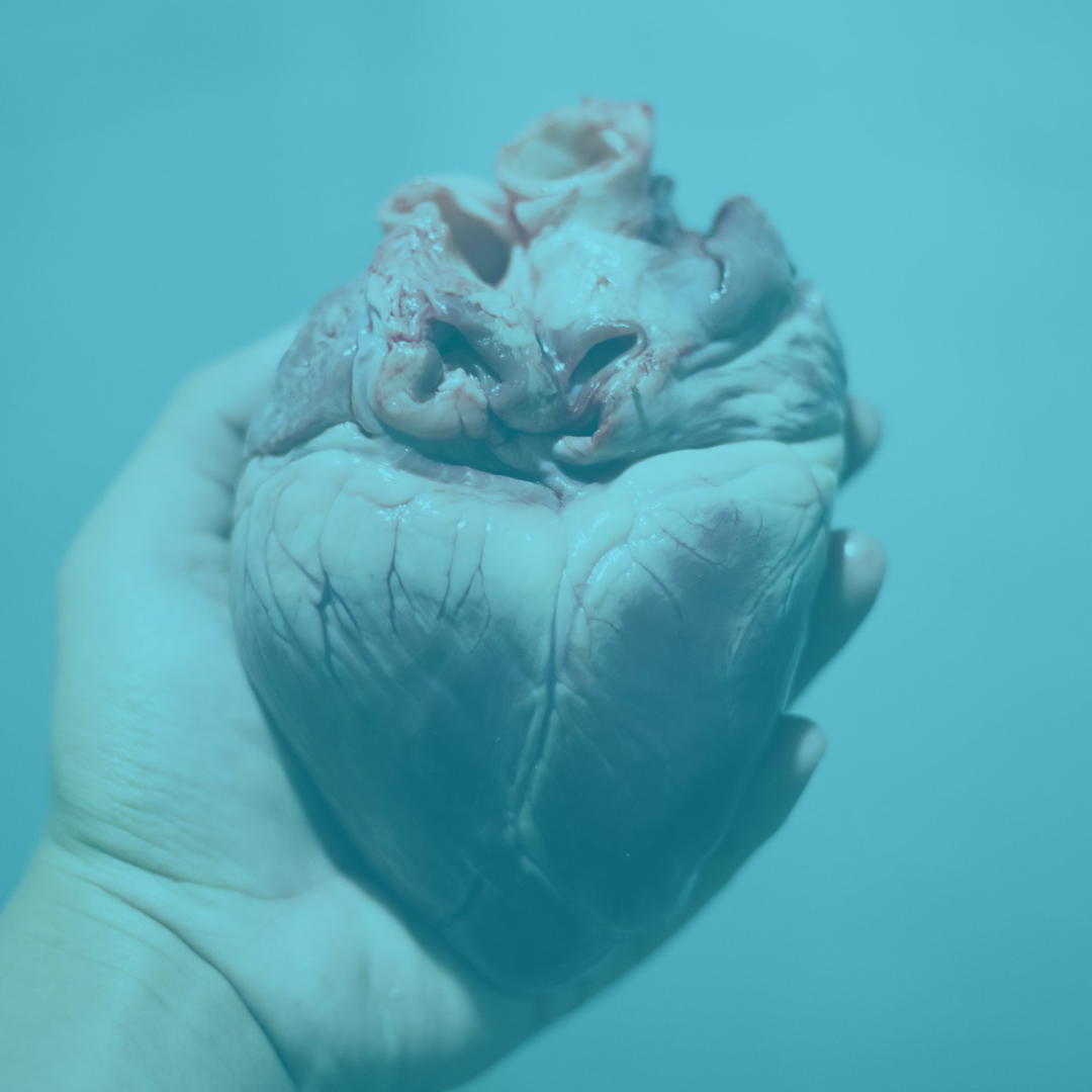 ¿Qué es la donación de órganos?